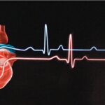 A vitamina C, o colesterol e os ataques cardiovasculares